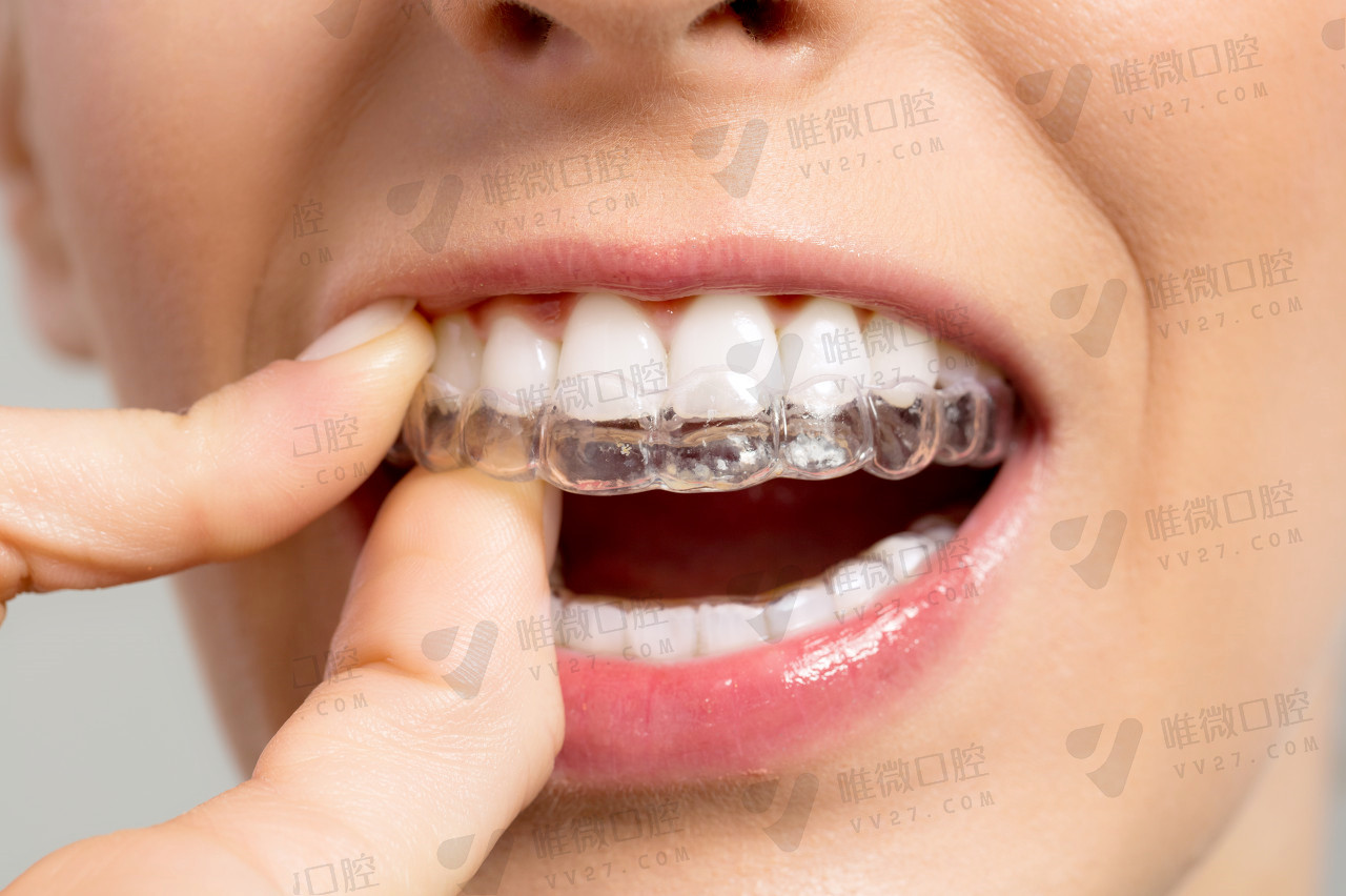 宁波海曙牙博士口腔医院：牙齿矫正后向外凸的价格费用表查询